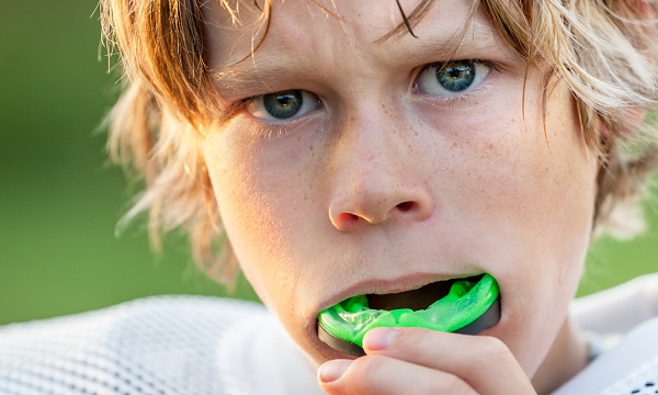 Custom Mouthguards