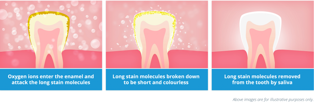 the process of teeth whitening: oxygen ions attach to particles that cover the tooth and get washed away by saliva, leaving the tooth naturally white